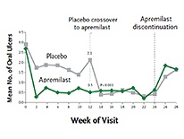 Apremilast for Behçet’s Syndrome Apremilast for Behçet’s Syndrome