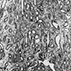 Prolonged Survival of Human-Kidney Homografts by Immunosuppressive Drug Therapy Prolonged Survival of Human-Kidney Homografts by Immunosuppressive Drug Therapy