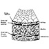 The Pathogenesis of Atherosclerosis