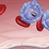 A Blood Mystery