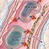 Natalizumab and Risk of PML Natalizumab and Risk of PML