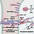Focal Segmental Glomerulosclerosis Focal Segmental Glomerulosclerosis