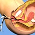 Pelvic Examination