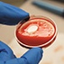 Endometrial Biopsy