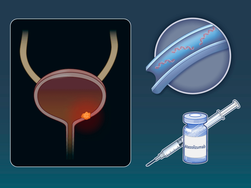ctDNA-Guided Atezolizumab in Bladder Cancer